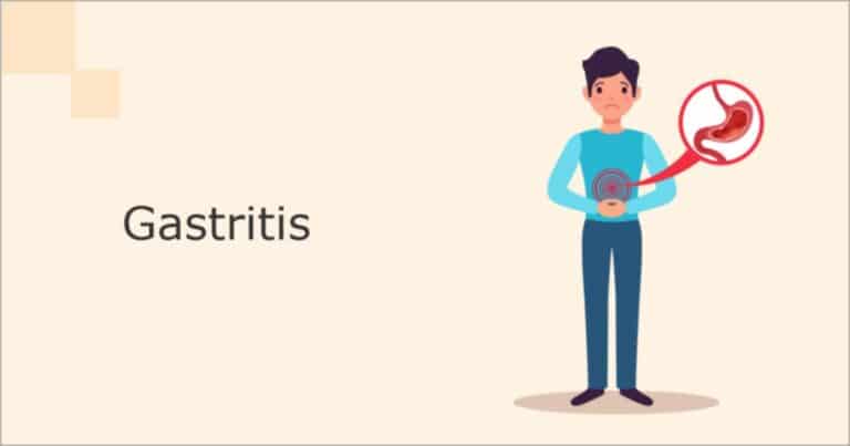 How To Relieve Gastritis Pain Fast? | All About Gastritis